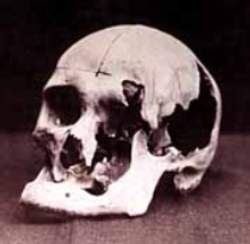 Cráneo de Andrew Borden